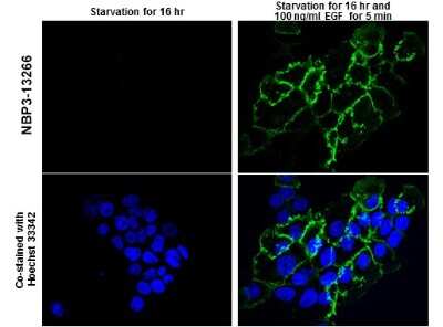 Immunocytochemistry/ Immunofluorescence: EGFR [p Tyr1045] Antibody [NBP3-13266]